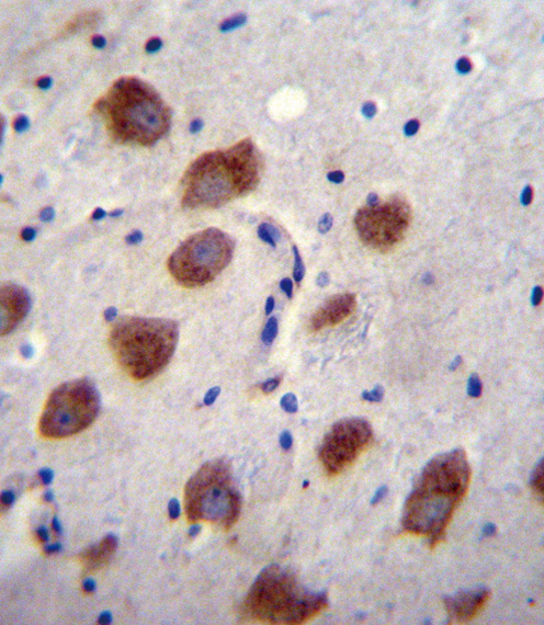 ALK-6 / BMPR1B Antibody - BMPR1B Antibody immunohistochemistry of formalin-fixed and paraffin-embedded human brain tissue followed by peroxidase-conjugated secondary antibody and DAB staining.