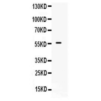 ALK-6 / BMPR1B Antibody - BMPR1B antibody, ,Western blot. All lanes: Anti BMPR1B at 0.5 ug/ml. WB: Human Placenta Tissue Lysate at 50 ug. Predicted band size: 57 kD. Observed band size: 57 kD.
