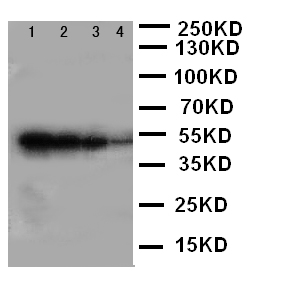 ALK-6 / BMPR1B Antibody - WB of ALK-6 / BMPR1B antibody. Recombinant Protein Detection Source:. E.coli derived -recombinant Human BMPR1B, 49.0KD. (162aa tag+D17-D289). . Lane 1: Recombinant Human BMPR1B Protein 10ng. Lane 2: Recombinant Human BMPR1B Protein 5ng. Lane 3: Recombinant Human BMPR1B Protein 2.5ng. Lane 4: Recombinant Human BMPR1B Protein 1.25ng..