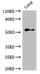 ALK-6 / BMPR1B Antibody - Positive WB detected in:Rat lung tissue;All lanes:BMPR1B antibody at 2.4?g/ml;Secondary;Goat polyclonal to rabbit IgG at 1/50000 dilution;Predicted band size: 57,61 KDa;Observed band size: 57 KDa;