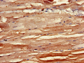 ALK-6 / BMPR1B Antibody - Immunohistochemistry of paraffin-embedded human skeletal muscle tissue using BMPR1B Antibody at dilution of 1:100