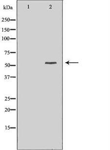 ALK-6 / BMPR1B Antibody - Western blot analysis of extracts of mouse brain tissue using BMPR1B antibody. The lane on the left is treated with the antigen-specific peptide.