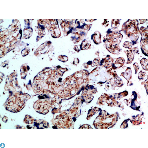 ALK-6 / BMPR1B Antibody - Immunohistochemical analysis of paraffin-embedded Human-placenta, antibody was diluted at 1:100.