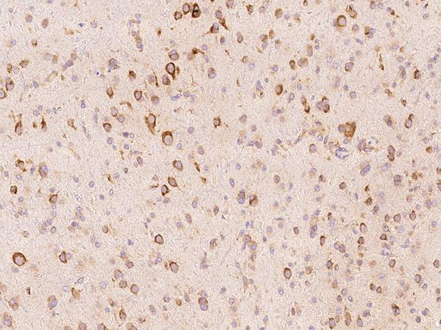ALK-6 / BMPR1B Antibody - Immunochemical staining of human BMPR1B in human brain with rabbit polyclonal antibody at 1:1000 dilution, formalin-fixed paraffin embedded sections.