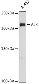 ALK Antibody - Western blot analysis of extracts of A-431 cells using ALK Polyclonal Antibody at dilution of 1:1000.