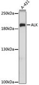ALK Antibody - Western blot analysis of extracts of A-431 cells using ALK Polyclonal Antibody at dilution of 1:1000.