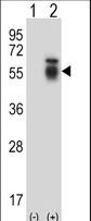 ALK2 / ACVR1 Antibody - Western blot of ACVR1 (arrow) using rabbit polyclonal ACVR1 Antibody. 293 cell lysates (2 ug/lane) either nontransfected (Lane 1) or transiently transfected (Lane 2) with the ACVR1 gene.