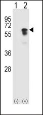 ALK2 / ACVR1 Antibody - Western blot of ACVR1 (arrow) using rabbit polyclonal ACVR1 Antibody (R147). 293 cell lysates (2 ug/lane) either nontransfected (Lane 1) or transiently transfected (Lane 2) with the ACVR1 gene.