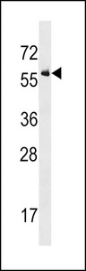 ALK2 / ACVR1 Antibody - ACVR1 Antibody (R147) western blot of U937 cell line lysates (35 ug/lane). The ACVR1 antibody detected the ACVR1 protein (arrow).