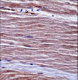 ALK2 / ACVR1 Antibody - Mouse Acvr1 Antibody immunohistochemistry of formalin-fixed and paraffin-embedded mouse skeletal muscle followed by peroxidase-conjugated secondary antibody and DAB staining.