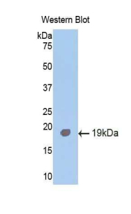 ALK2 / ACVR1 Antibody - Western blot of recombinant ALK2 / ACVR1.  This image was taken for the unconjugated form of this product. Other forms have not been tested.
