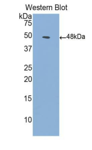 ALK2 / ACVR1 Antibody - Western blot of ALK2 / ACVR1 antibody.