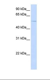 ALK2 / ACVR1 Antibody - Transfected 293T cell lysate. Antibody concentration: 1.0 ug/ml. Gel concentration: 12%.  This image was taken for the unconjugated form of this product. Other forms have not been tested.