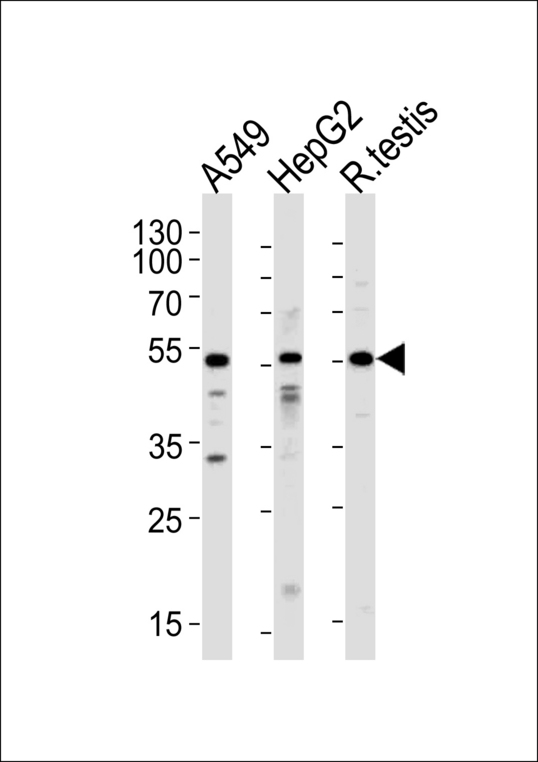 ALK2 / ACVR1 Antibody - Western blot of lysates from A549,HepG2 cell line and rat testis tissue (from left to right),using ACVR1 Antibody. Antibody was diluted at 1:1000 at each lane. A goat anti-rabbit IgG H&L (HRP) at 1:5000 dilution was used as the secondary antibody.Lysates at 35ug per lane.