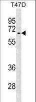 ALK2 / ACVR1 Antibody - ACVR1 Antibody western blot of T47D cell line lysates (35 ug/lane). The ACVR1 antibody detected the ACVR1 protein (arrow).