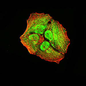 ALK2 / ACVR1 Antibody - Immunofluorescence analysis of Hela cells using ACVR1 mouse mAb (green). Blue: DRAQ5 fluorescent DNA dye. Red: Actin filaments have been labeled with Alexa Fluor- 555 phalloidin. Secondary antibody from Fisher