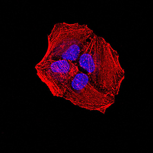 ALK2 / ACVR1 Antibody - Immunofluorescence analysis of Hela cells using ACVR1 mouse mAb. Blue: DRAQ5 fluorescent DNA dye. Red: Actin filaments have been labeled with Alexa Fluor- 555 phalloidin.