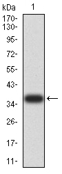 ALK2 / ACVR1 Antibody - Western blot analysis using ACVR1 mAb against human ACVR1 (AA: 21-120) recombinant protein. (Expected MW is 37.1 kDa)