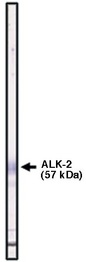 ALK2 / ACVR1 Antibody - Western blot of ALK-2 antibody (ch-Alk2) on ALK-2 fusion protein.