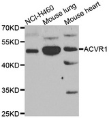 ALK2 / ACVR1 Antibody - Western blot analysis of extracts of various cell lines.