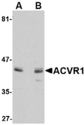 ALK2 / ACVR1 Antibody - Western blot of ACVR1 in A549 cell lysate with ACVR1 antibody at 1 ug/ml in (A) the absence and (B) the presence of blocking peptide.