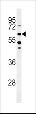 ALK3 / BMPR1A Antibody - BMPR1A -C180 western blot of HeLa cell line lysates (35 ug/lane). The BMPR1A antibody detected the BMPR1A protein (arrow).