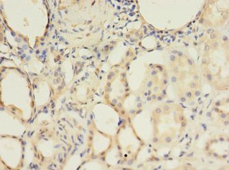 ALK3 / BMPR1A Antibody - Immunohistochemistry of paraffin-embedded human kidney tissue using antibody at 1:100 dilution.  This image was taken for the unconjugated form of this product. Other forms have not been tested.