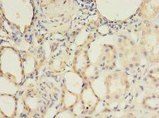 ALK3 / BMPR1A Antibody - Immunohistochemistry of paraffin-embedded human kidney tissue using antibody at 1:100 dilution.  This image was taken for the unconjugated form of this product. Other forms have not been tested.