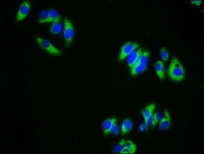 ALK3 / BMPR1A Antibody - Immunofluorescence staining of HepG2 cells with BMPR1A Antibody at 1:333, counter-stained with DAPI. The cells were fixed in 4% formaldehyde, permeabilized using 0.2% Triton X-100 and blocked in 10% normal Goat Serum. The cells were then incubated with the antibody overnight at 4°C. The secondary antibody was Alexa Fluor 488-congugated AffiniPure Goat Anti-Rabbit IgG(H+L).