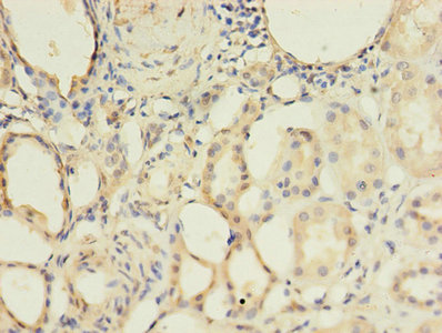ALK3 / BMPR1A Antibody - Immunohistochemistry of paraffin-embedded human kidney tissue using BMPR1A Antibody at dilution of 1:100
