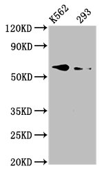 ALK3 / BMPR1A Antibody - Western Blot Positive WB detected in: K562 whole cell lysate, 293 whole cell lysate All lanes: BMPR1A antibody at 3.3µg/ml Secondary Goat polyclonal to rabbit IgG at 1/50000 dilution Predicted band size: 61 kDa Observed band size: 61 kDa