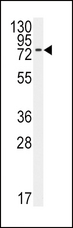 ALK3 / BMPR1A Antibody - Western blot of anti-BMPR1A Antibody (N-term K36) in 293 cell line lysates (35 ug/lane). BMPR1A(arrow) was detected using the purified antibody.