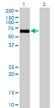 ALK3 / BMPR1A Antibody - Western Blot analysis of BMPR1A expression in transfected 293T cell line by BMPR1A monoclonal antibody (M01), clone 4C4.Lane 1: BMPR1A transfected lysate(60.2 KDa).Lane 2: Non-transfected lysate.