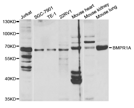 ALK3 / BMPR1A Antibody - Western blot analysis of extracts of various cell lines, using BMPR1A antibody.