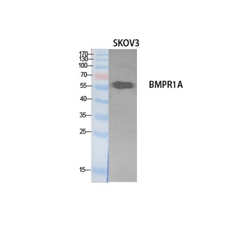 ALK3 / BMPR1A Antibody - Western Blot analysis of extracts from SKOV3 cells using BMPR1A Antibody.