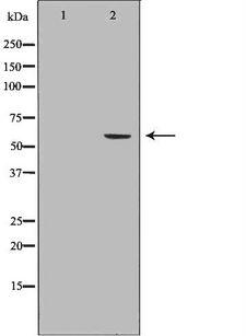 ALK3 / BMPR1A Antibody - Western blot analysis of HeLa whole cells lysates using BMPR1A antibody. The lane on the left is treated with the antigen-specific peptide.