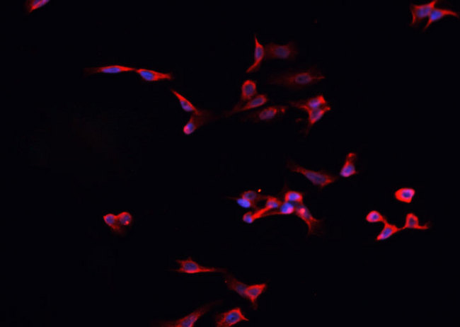 ALK3 / BMPR1A Antibody - Staining HepG2 cells by IF/ICC. The samples were fixed with PFA and permeabilized in 0.1% Triton X-100, then blocked in 10% serum for 45 min at 25°C. The primary antibody was diluted at 1:200 and incubated with the sample for 1 hour at 37°C. An Alexa Fluor 594 conjugated goat anti-rabbit IgG (H+L) antibody, diluted at 1/600, was used as secondary antibody.