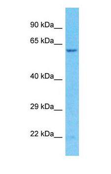 ALK3 / BMPR1A Antibody - Western blot of BMPR1A Antibody with human Jurkat Whole Cell lysate.  This image was taken for the unconjugated form of this product. Other forms have not been tested.