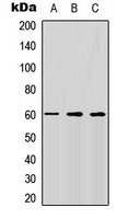 ALK3 / BMPR1A Antibody - Western blot analysis of CD292 expression in HEK293T (A); Raw264.7 (B); H9C2 (C) whole cell lysates.