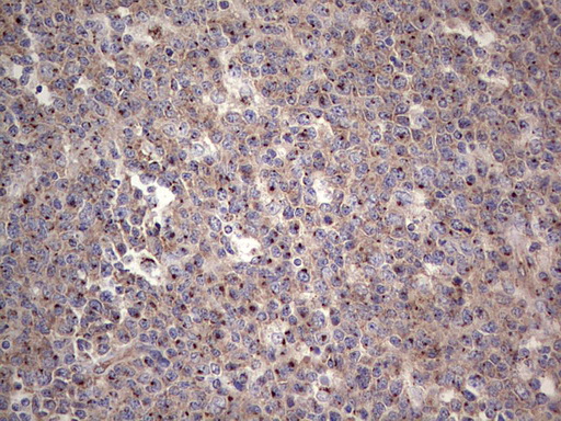 ALKBH1 / ALKB Antibody - Immunohistochemical staining of paraffin-embedded Human tonsil within the normal limits using anti-ALKBH1 mouse monoclonal antibody. (Heat-induced epitope retrieval by 1 mM EDTA in 10mM Tris, pH8.5, 120C for 3min,