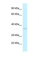 ALKBH1 / ALKB Antibody - ALKBH1 / ALKBH antibody Western blot of Fetal Kidney lysate. Antibody concentration 1 ug/ml.  This image was taken for the unconjugated form of this product. Other forms have not been tested.