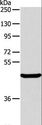 ALKBH1 / ALKB Antibody - Western blot analysis of Mouse pancreas tissue, using ALKBH1 Polyclonal Antibody at dilution of 1:400.