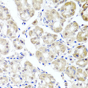 ALKBH4 Antibody - Immunohistochemistry of paraffin-embedded human stomach tissue.
