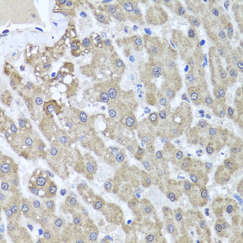 ALKBH4 Antibody - Immunohistochemistry of paraffin-embedded human liver injury tissue.