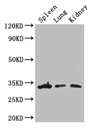 ALKBH4 Antibody - Positive WB detected in:Mouse spleen tissue,Mouse lung tissue,Mouse kidney tissue;All lanes: ALKBH4 antibody at 3ug/ml;Secondary;Goat polyclonal to rabbit IgG at 1/50000 dilution;Predicted band size: 34,5 kDa;Observed band size: 34 kDa;