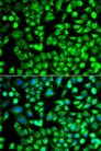 ALKBH4 Antibody - Immunofluorescence analysis of A549 cells using ALKBH4 antibody. Blue: DAPI for nuclear staining.