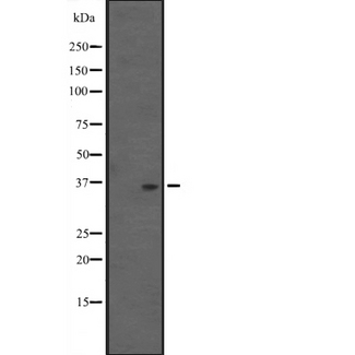 ALKBH4 Antibody - Western blot analysis of ALKBH4 expression in human fetal spleen lysate. The lane on the left is treated with the antigen-specific peptide.