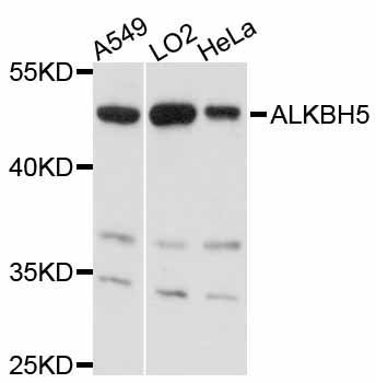 ALKBH5 Antibody - Western blot analysis of extracts of various cell lines, using ALKBH5 antibody at 1:3000 dilution. The secondary antibody used was an HRP Goat Anti-Rabbit IgG (H+L) at 1:10000 dilution. Lysates were loaded 25ug per lane and 3% nonfat dry milk in TBST was used for blocking. An ECL Kit was used for detection and the exposure time was 10s.