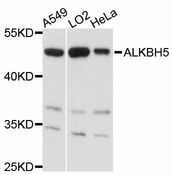 ALKBH5 Antibody - Western blot analysis of extracts of various cell lines, using ALKBH5 antibody at 1:3000 dilution. The secondary antibody used was an HRP Goat Anti-Rabbit IgG (H+L) at 1:10000 dilution. Lysates were loaded 25ug per lane and 3% nonfat dry milk in TBST was used for blocking. An ECL Kit was used for detection and the exposure time was 10s.