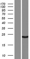 ALKBH6 Protein - Western validation with an anti-DDK antibody * L: Control HEK293 lysate R: Over-expression lysate